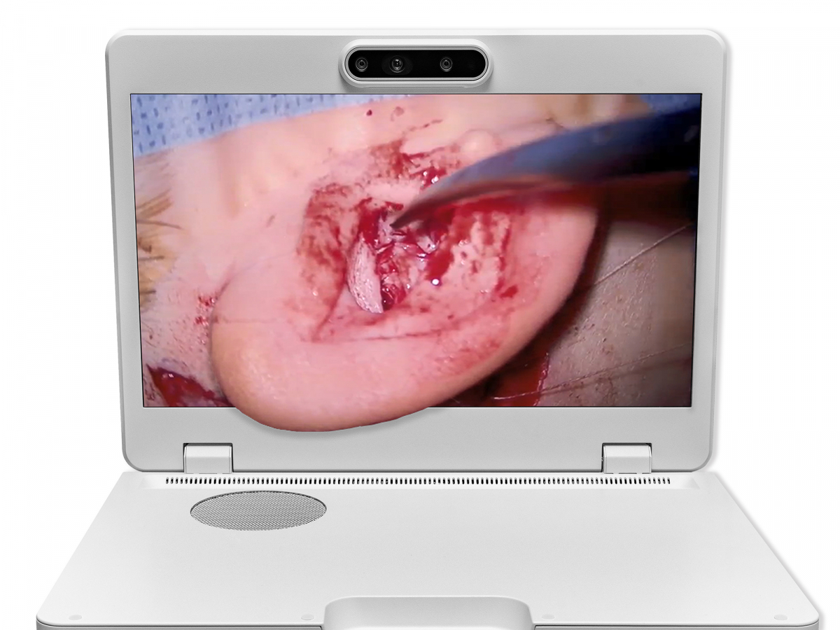 达擎之＂Heads-up 3D显微手术显示系统＂，整合4K裸眼3D显示及眼球追踪系统，具备快速追踪人眼移动位置功能，减轻医师长时间维持固定姿势的负担，让医师能有更宽广清晰的3D立体视野及更舒适的姿势来执行手术。